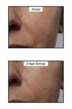 Murad Rapid Collagen Infusion 3