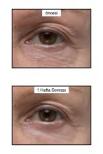 Murad Renewing Eye Cream 3