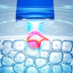 Foreo ESPADA 2 Akne Karşıtı Cilt Bakım Cihazı, Cobalt Blue - Görsel 2