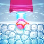 Foreo ESPADA 2 Akne Karşıtı Cilt Bakım Cihazı, Fuschia - Görsel 3