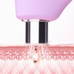 Foreo KIWI Derma Diamond Mikrodermabrazyon Vakumlu Siyah Nokta Temizleme Cihazı - Görsel 3